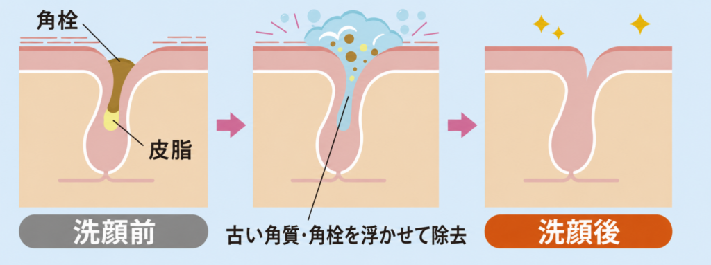 古い角質・角栓を浮かせて除去する仕組みの図解